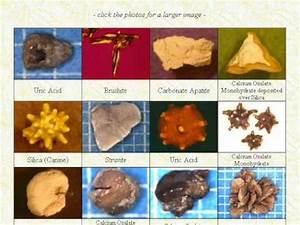 Types Of Stones Kidney Stones Body Health Healthy Eating