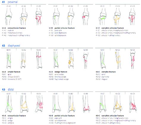 Ao Classification For Tibia Fractures Copyright Ao Foundation Download Scientific Diagram