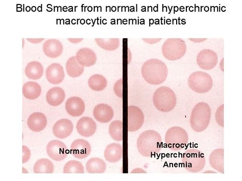 Blood Erythrocytes Rbc Blood Smear With Erythrocytes Red