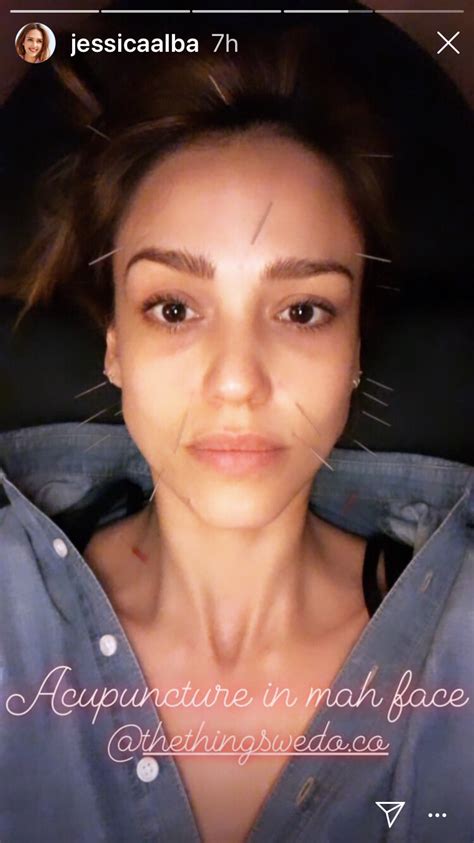 Jessica Alba Just Posted A No Makeup Selfie With Needles All Over Her Face