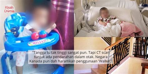 Gara Gara Walker Terbalik Sebelum Jatuh Tangga Baby Retak Tempurung