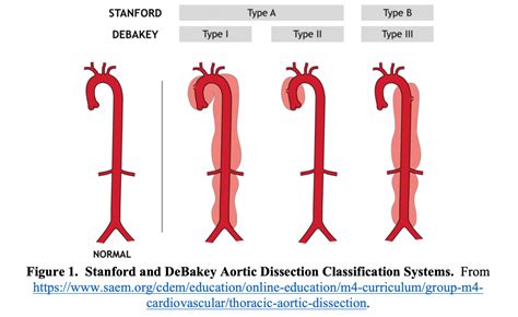 Emergency Medicine Educationaortic Dissection Why Do We