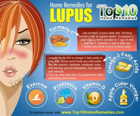 Home Remedies For Lupus Top 10 Home Remedies