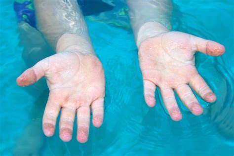 mundane mysteries why do our fingers get wrinkly when swimming star 99 9