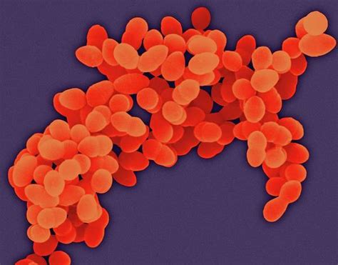 Staphylococcus Aureus Art Print By Dennis Kunkel Microscopyscience