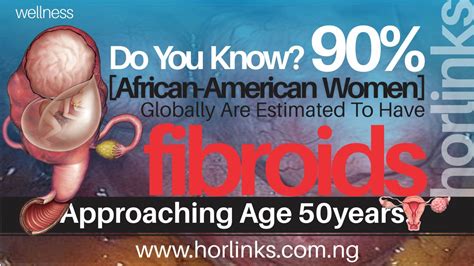 Fibroids Health Nigeria