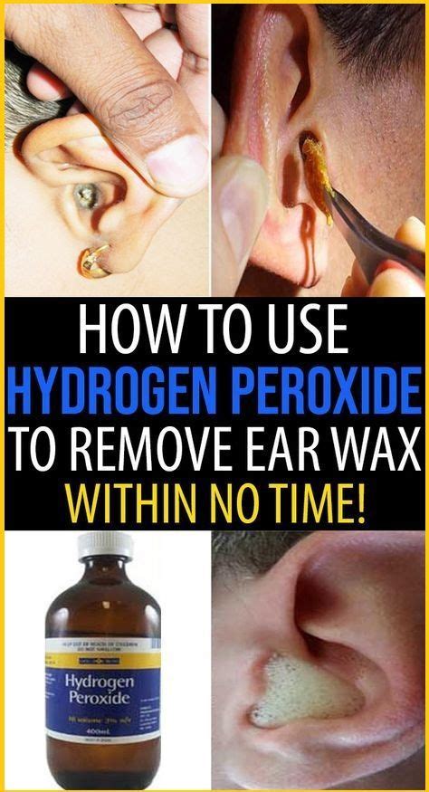Easy Removal Of Earwax With Hydrogen Peroxide Ear Cleaning Wax Clean