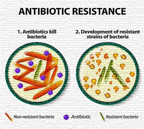 Bacteria Resistant To Antibiotics Cdc Threat Levels
