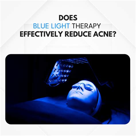 How Effective Is Blue Light Therapy For Acne Chosen Store