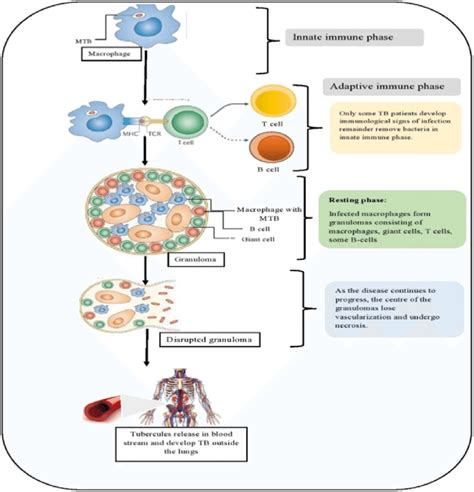 Pathogenesis Of Primary Tuberculosis