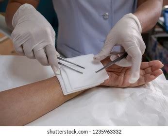 Doctor Bandaging Upper Limb Patient After Stock Photo 1235963332