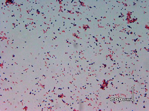 Gram Stain Performed From Positive Blood Culture Vial Revealing The