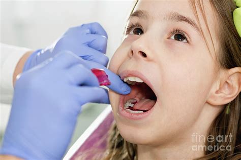 Dental Braces Photograph By Microgen Images Science Photo Library Fine Art America