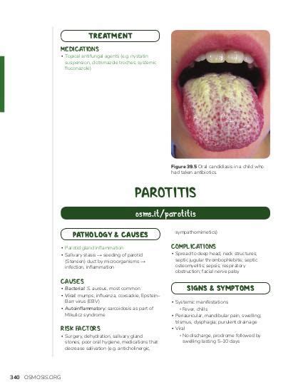Parotitis Osmosis