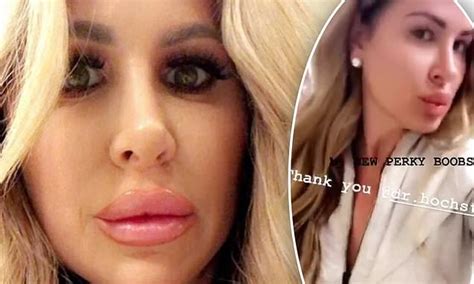 Kim Zolciak 40 Claps Back At Ridiculous Lip Filler Trolls Daily Mail Online