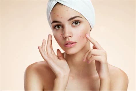 Effective Strategies To Safeguard Skin Health Preventing Skin Diseases