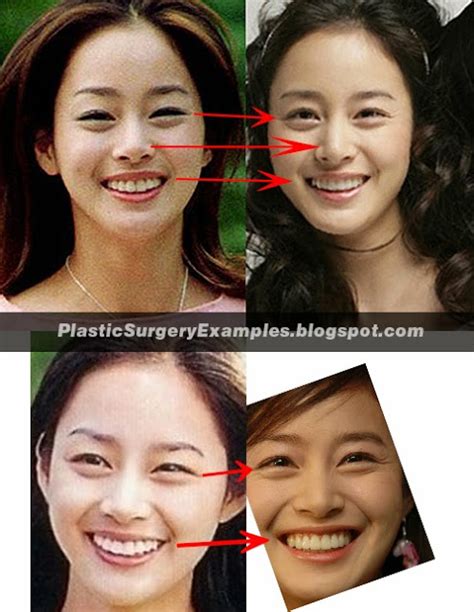 Kim tae hee is looked as a divine goddess by korean fans. Plastic Surgery Examples: Kim Tae Hee plastic surgery ...