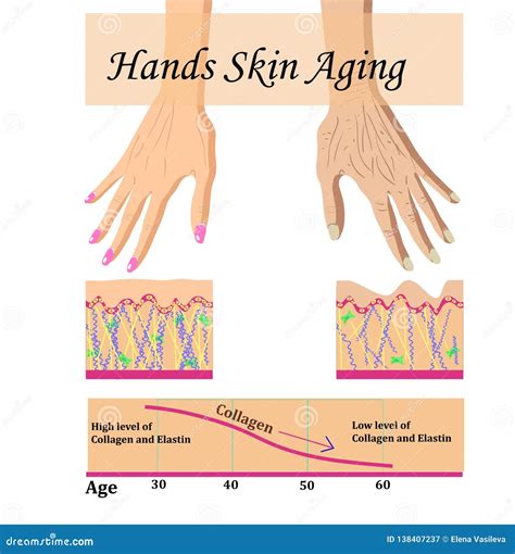 Skin Aging Cartoon Vector 49053101