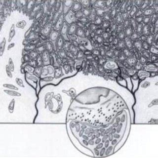 Brief description of merkel cells, their function as receptors ( mechanoreceptors ), why they are called non keratinocytes and what are non keratinocytes. Electron micrograph of Merkel cell in the basal layer of ...