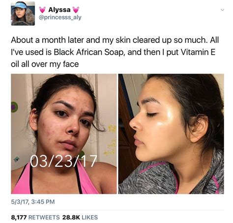 @httpsamandaaa Face Skin Care, Makeup Skin Care, Skin Tips, Skin Care