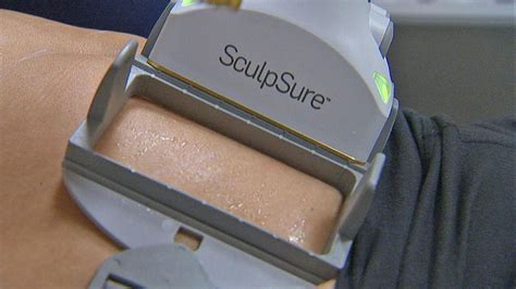 Pin On SculpSure