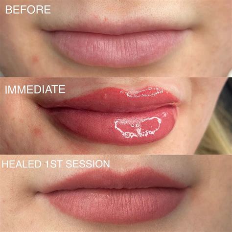 Permanent Makeup Full Lips Before And After Saubhaya Makeup