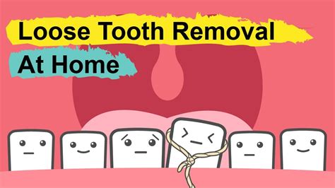 How To Pull Out A Loose Tooth At Home Youtube