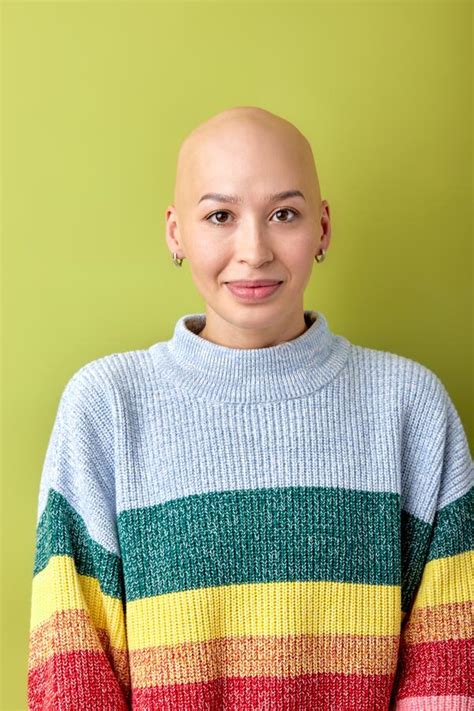Portrait Of Positive Smiling Bald Female In Casual Wear Posing Looking At Camera Stock Image