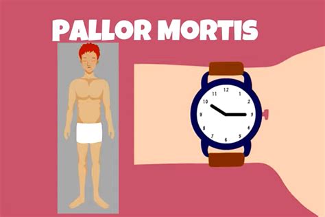 Pallor Mortis What Happens To The Body Immediately After Death