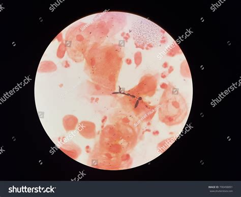 Candida Albicans Gram Stain Stock Photo 790498891 Shutterstock
