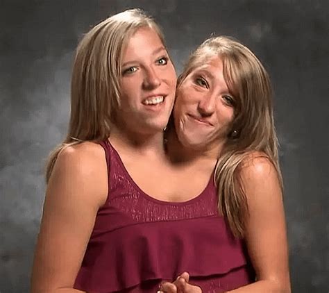 conjoined twins abby and brittany hensel see comments for more info u truth warrior 30