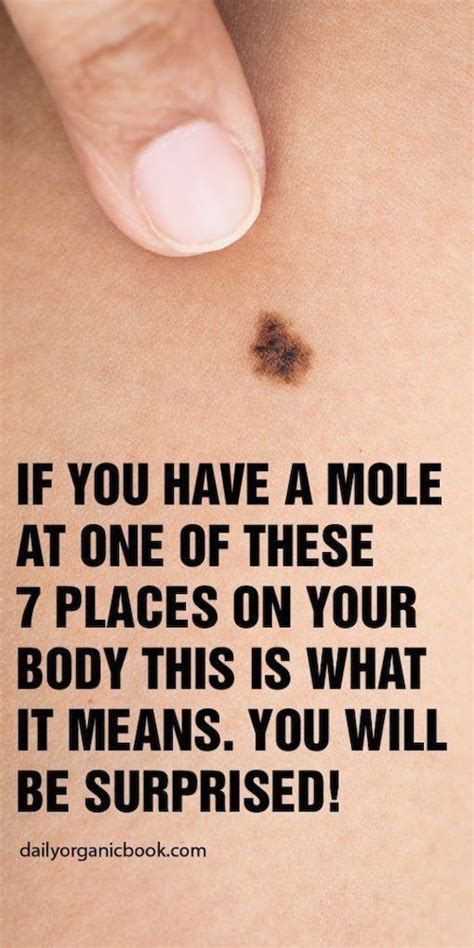 If You Have A Mole At One Of These 7 Places On Your Body This Is What