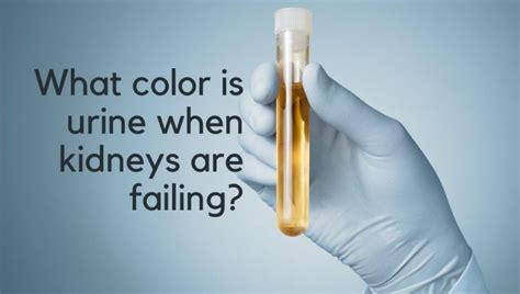Kidney failure facts and figures. What color is urine when kidneys are failing? | St Pete ...