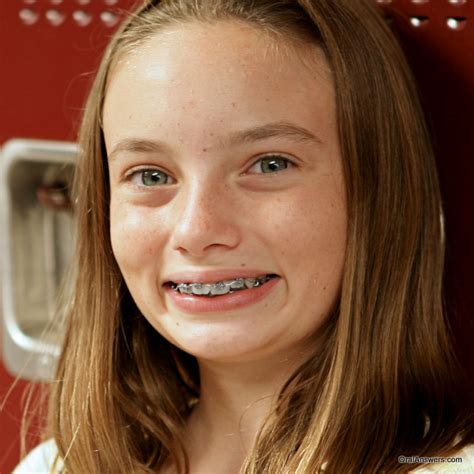 60 Photos Of Teenagers With Braces Robweigner S Blog
