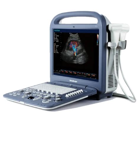 Sonoscape S2 Portable Ultrasound Machine Keebomed Diagnostic