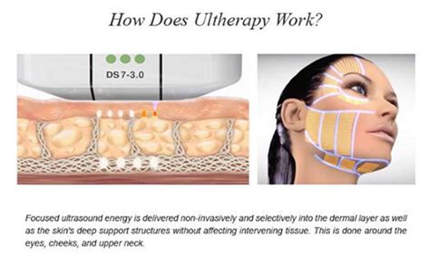 Hifu Treatment High Intensity Focused Ultrasound Treatment Mumbai India