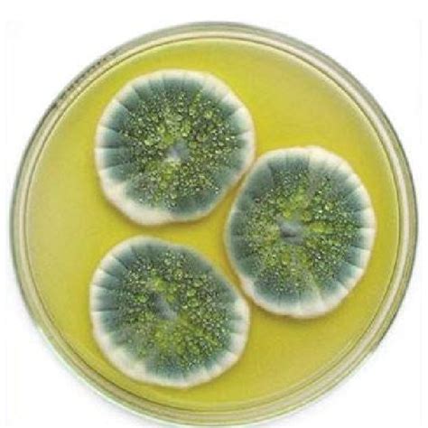 Macroscopic Picture Of Penicillium Crysogeniam Download Scientific
