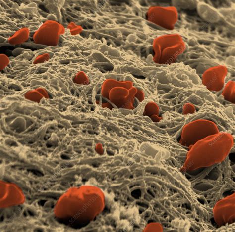 Blood Clot Stock Image C0085080 Science Photo Library