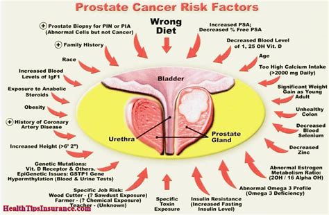 The other values wouldn't tell us much else about the possibility of prostate cancer. Prostate Cancer Quotes. QuotesGram