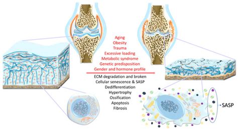 Biology Free Full Text Pathogenesis Of Osteoarthritis Risk Factors
