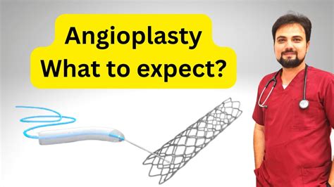 Angioplasty What To Expect Youtube