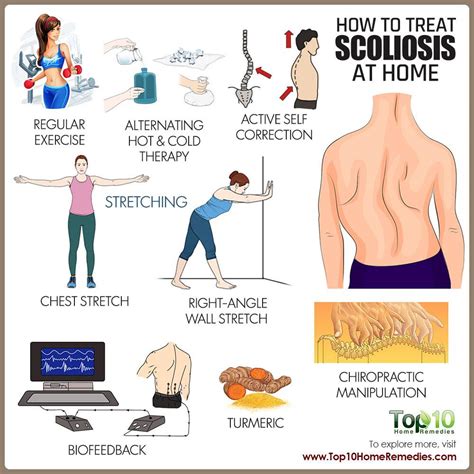 how to deal with scoliosis top 10 home remedies