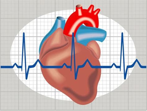 Heart Arrhythmias Types