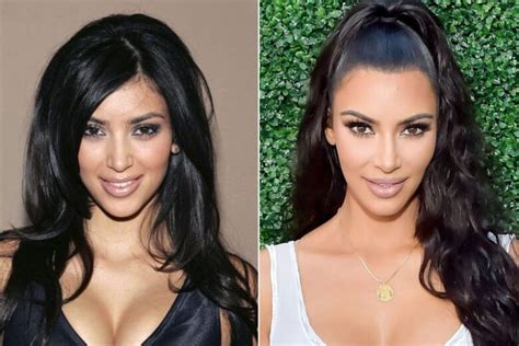 Kim Kardashian Opens Up About Plastic Surgery Demotix