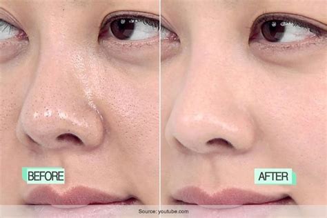Skin Pores Are Always A Problem Here You Learn How To Tighten Pores