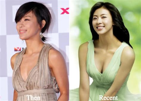 Ha Ji Won Plastic Surgery Before And After Photos Latest Plastic