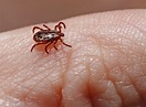 Rocky Mountain Spotted Fever During Pregnancy - The Pulse