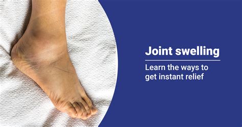 What You Need To Know About Joint Swelling