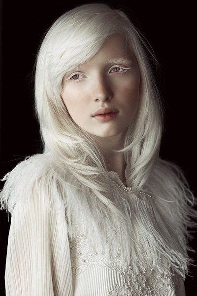 Pin By Gregory Kay On Pretty Girls Albino Model Albino Girl Unique