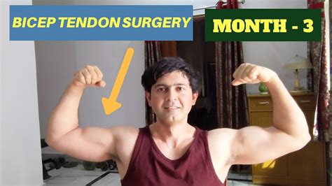 Distal Bicep Tendon Repair Recovery Month 3 Youtube